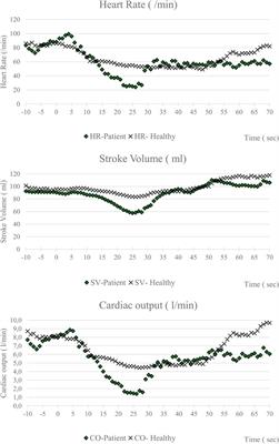 Autonomic dysfunction as a possible cause of sudden cardiac death in swimming sports